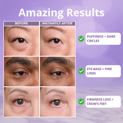 Envara™ Instant Eye Tightener